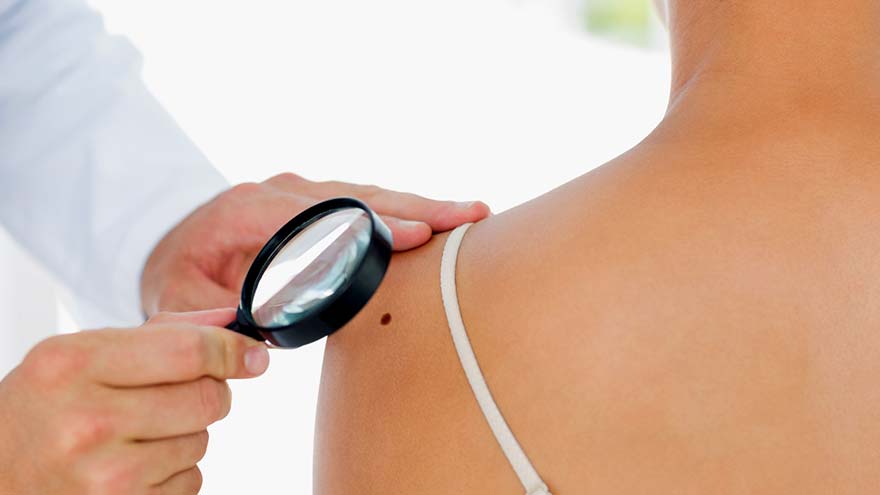 Patient being examined for skin cancer